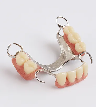 Коронки на зуб